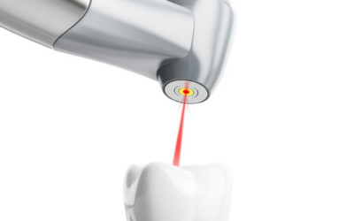 Il laser in odontoiatria