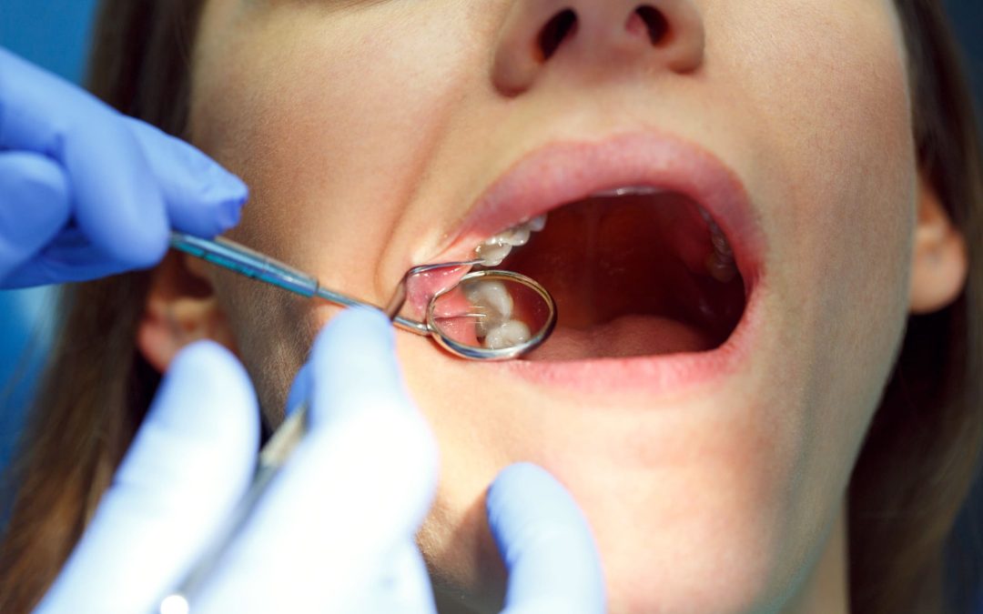 Ruolo delle visite regolari dal dentista