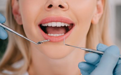 L’aspetto dei denti influisce sulla salute mentale e l’autostima