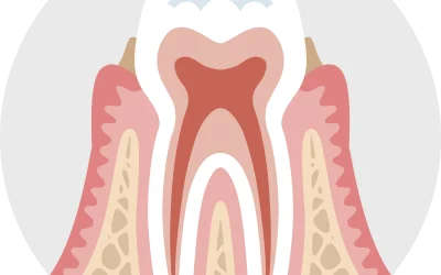 Nuove prospettive nella cura della parodontite