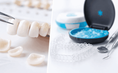 Faccette dentali o apparecchio invisibile? Estetica e salute del sorriso