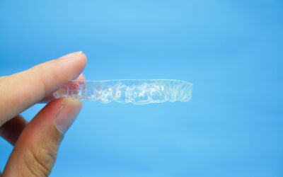 Invisalign Monza Brianza: costi e tempi