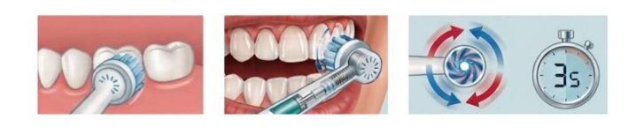 Tecnica corretta con lo spazzolino elettrico: testina appoggiata sul dente per circa 3 secondi senza pressione